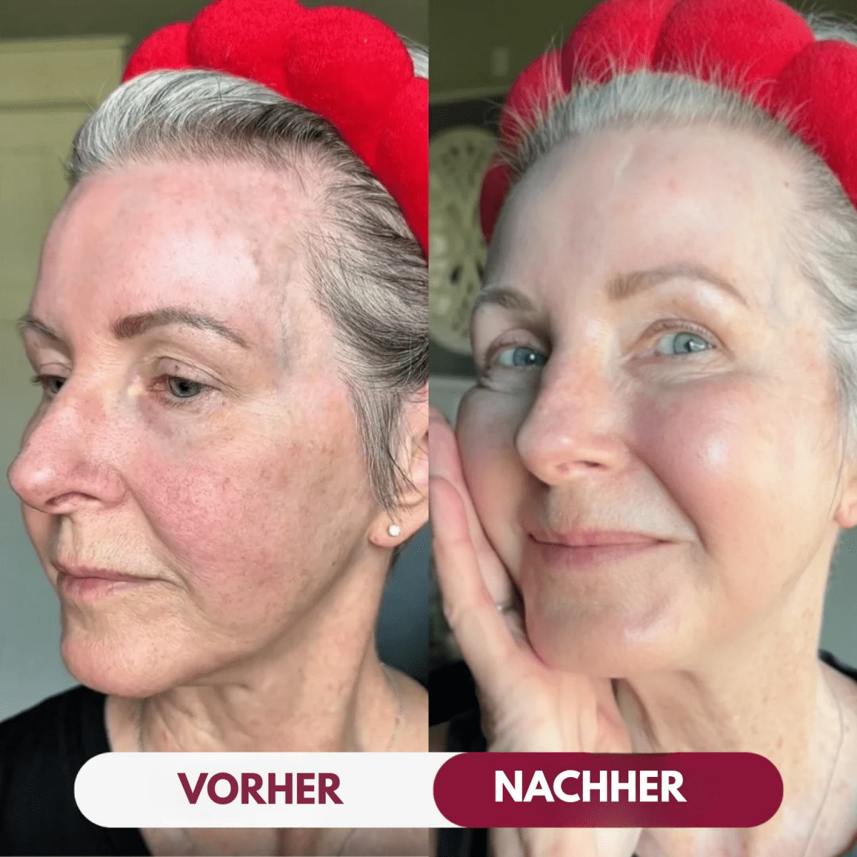 Nolva™: Kollagen-Maske NOLVA Nolva   4 Masken (Kennenlern-Set) Nolva™: Kollagen-Maske