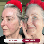Nolva™: Kollagen-Maske NOLVA Nolva   4 Masken (Kennenlern-Set) Nolva™: Kollagen-Maske